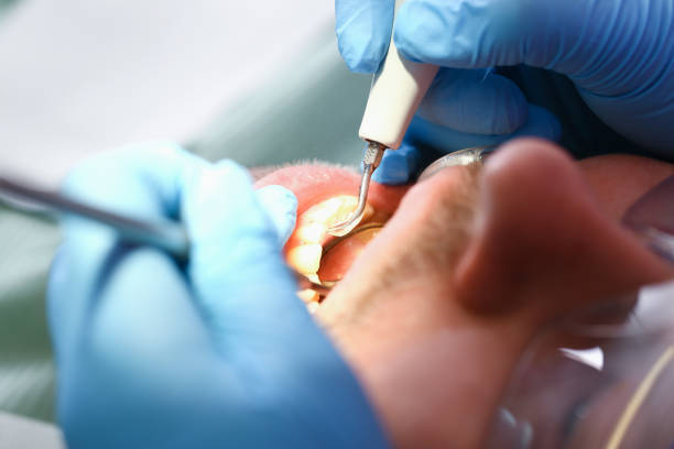 Professional Emergency Dental Service in FL